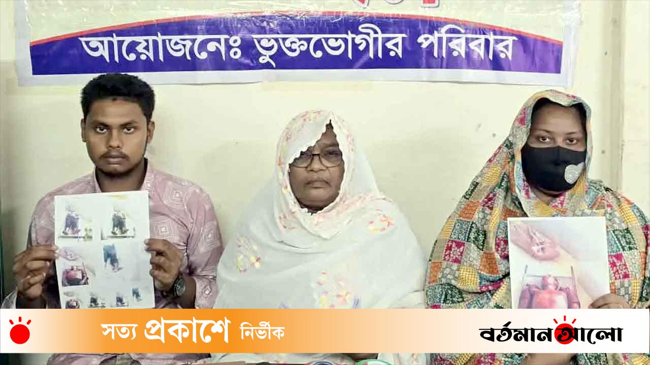 ​রাজশাহীতে লিচু বাগান পাহারার সময় মা-ছেলেকে কুপিয়ে জখম